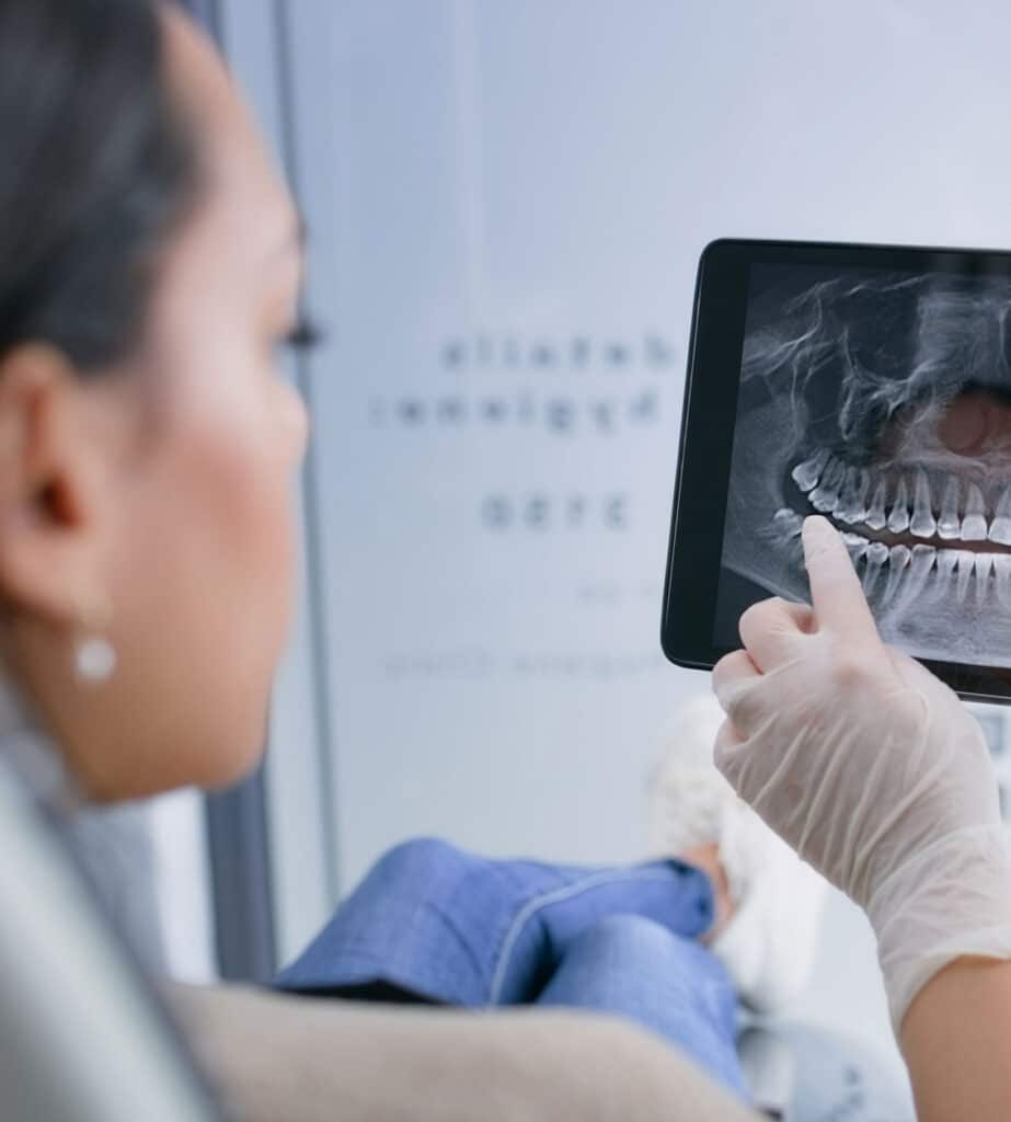 Dental x-rays being shown and explained to a female dental patient with the dental x-rays and a dentists gloved hand in clear view, everything else blurred around it