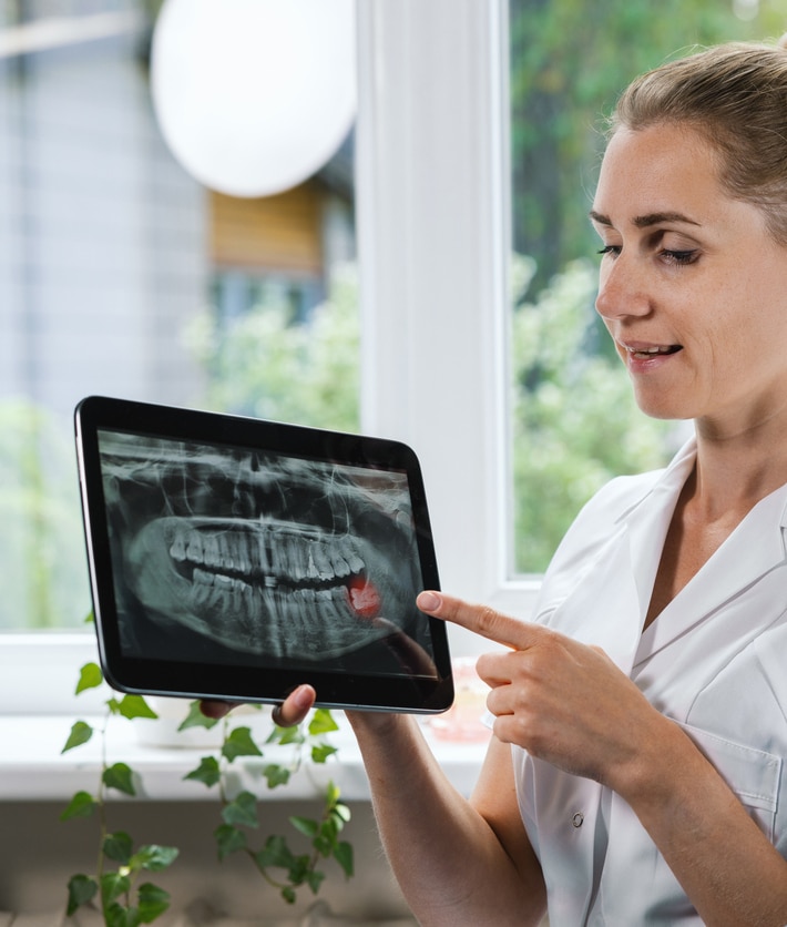 female dentist is explaining a wisdom teeth x-ray